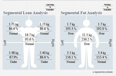 Segmental analysis